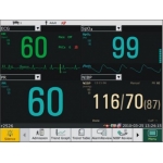 Monitor de paciente M50